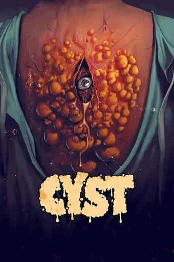 مشاهدة فيلم Cyst 2020 مترجم (2021)